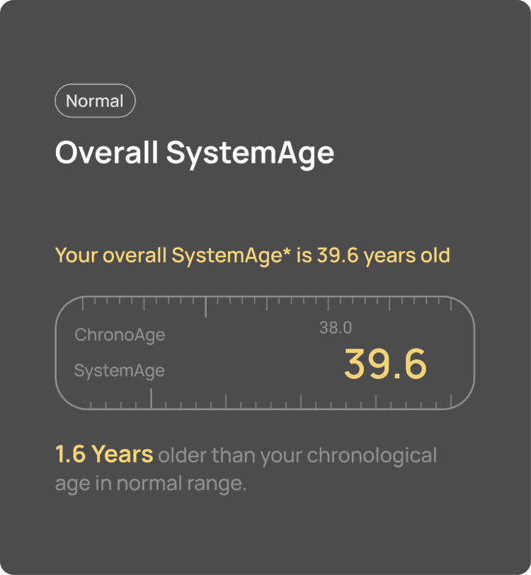 Age Analysis