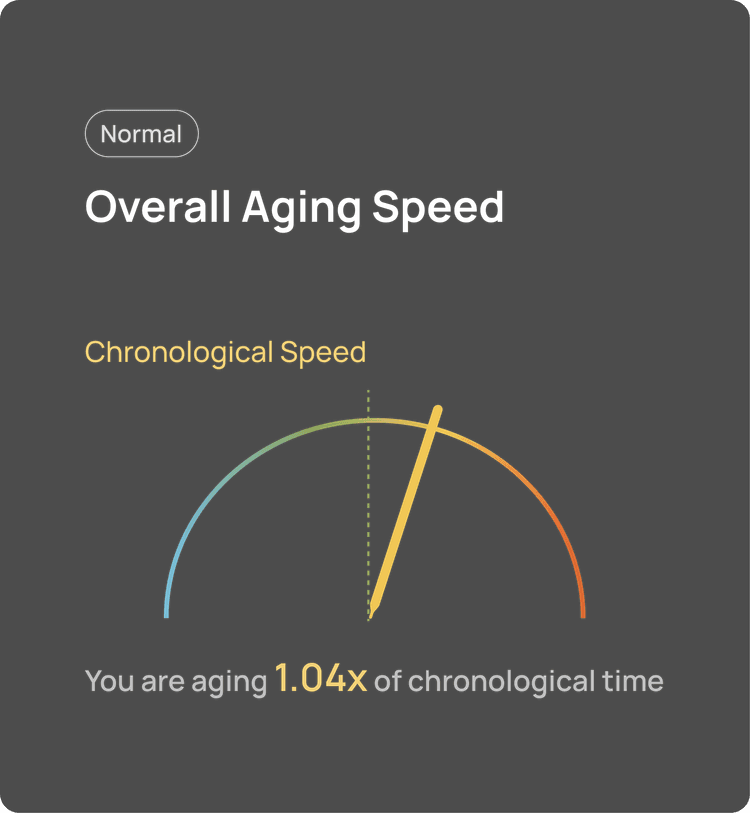 Age Analysis